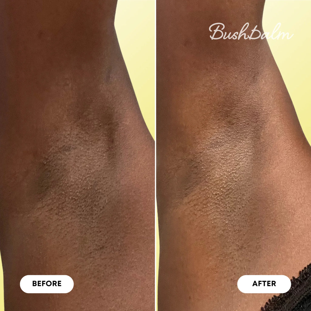 Bermuda Dark Spot Oil