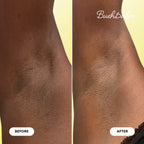 Bermuda Dark Spot Oil