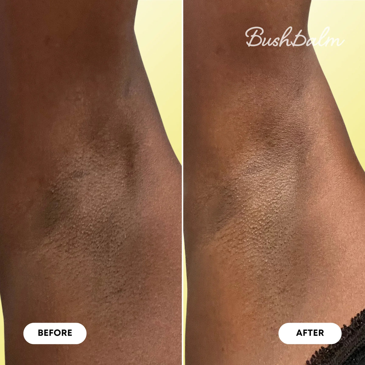 Bermuda Dark Spot Oil