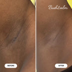 Watermelon Sugar Ingrown Hair Exfoliating Scrub