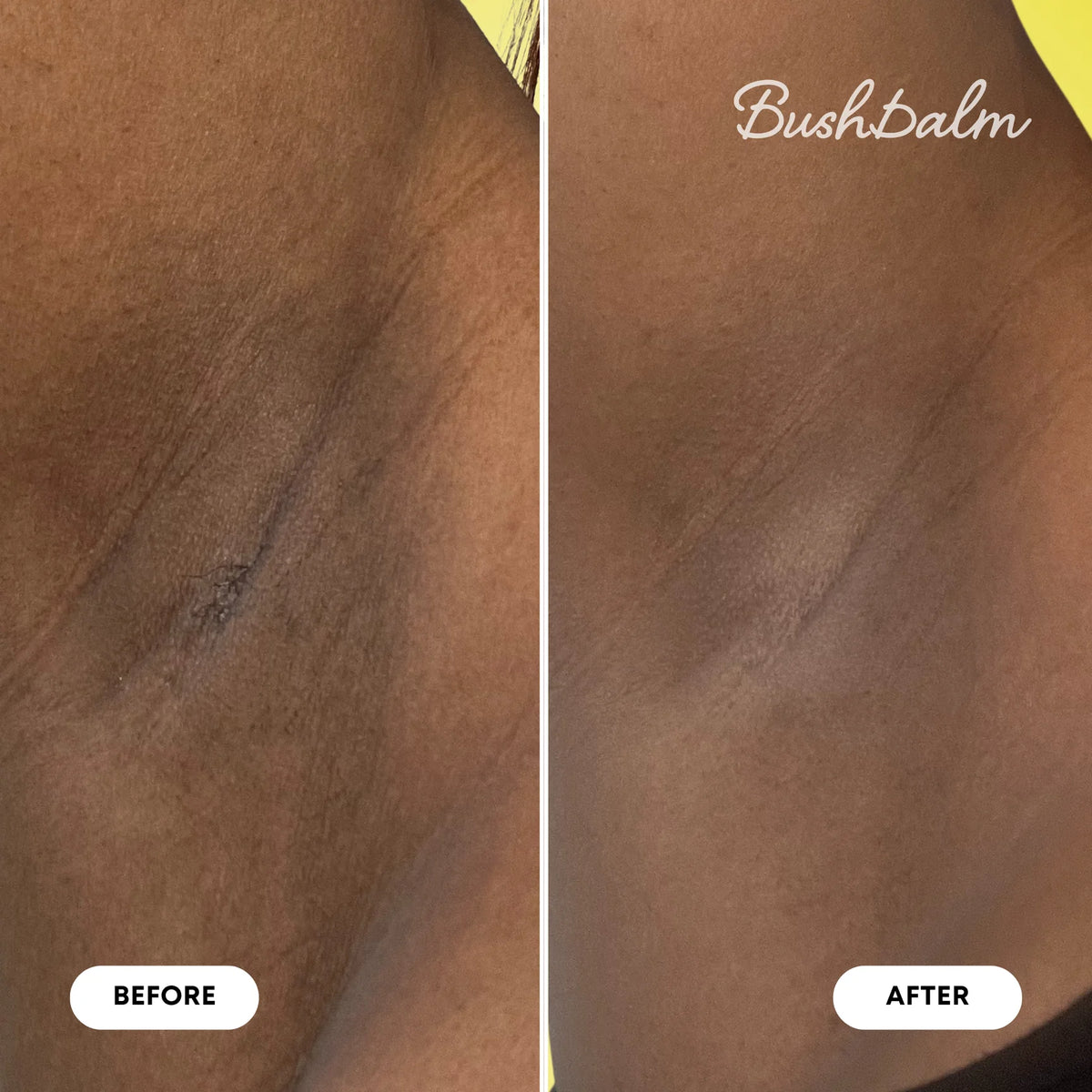 Watermelon Sugar Ingrown Hair Exfoliating Scrub