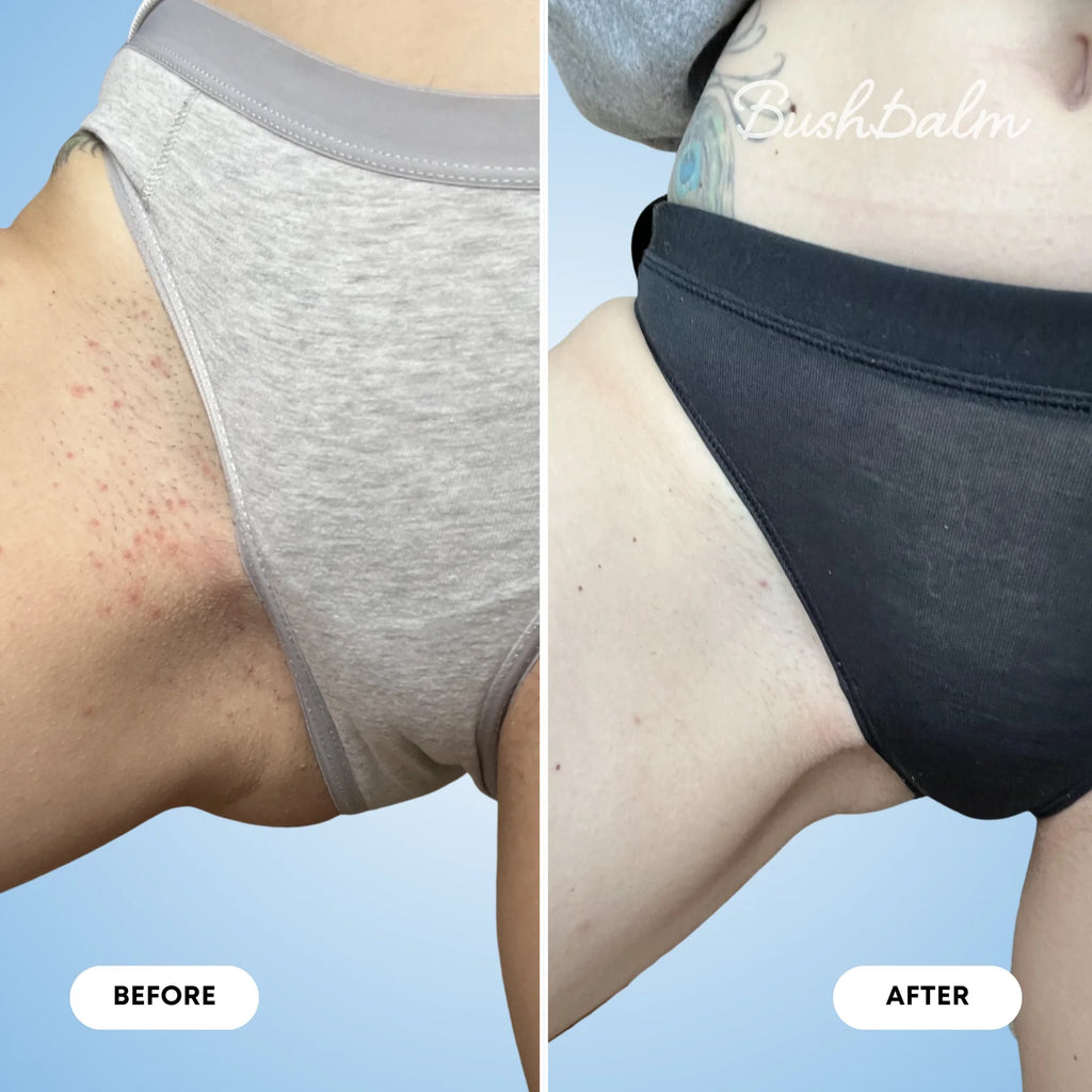 Nude Ingrown Hair Exfoliating Scrub