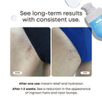 Nude Ingrown Hair Oil